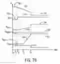 Fig. 09 - Slew-rate controlled supply voltage switching