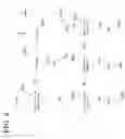 Fig. 10 - Simplifications for boundary strength derivation in deblocking