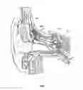 Fig. 33 - Electromechanical transducer with mechanical advantage