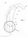 Fig. 02 - Hearing aid battery door module