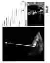 Fig. 17 - Systems and methods for obtaining accurate 3D modeling data using multiple cameras