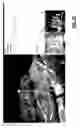 Fig. 20 - Systems and methods for obtaining accurate 3D modeling data using multiple cameras