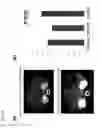 Fig. 13 - Transgenic mouse expressing kidney-specific human TGF-beta1, and biomarker for tissue fibrosis mouse model