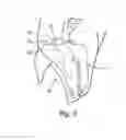 Fig. 03 - Device, work station and method for cutting the head off a slaughtered animal's carcass