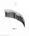 Fig. 07 - Hair extension