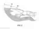 Fig. 04 - Heated ice scraper assembly