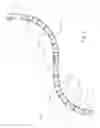 Fig. 03 - Endoscope stabilization system