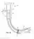 Fig. 03 - Side loading articulating laryngeal access system