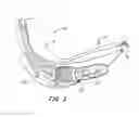 Fig. 05 - Side loading articulating laryngeal access system