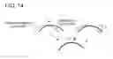 Fig. 15 - Anterior eye three-dimensional image processing apparatus and method of anterior eye three-dimensional image processing
