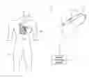 Fig. 01 - Localized magnetic field generator
