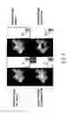 Fig. 07 - Apparatus and method for detecting bruxism