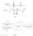 Fig. 04 - Running guiding method and device