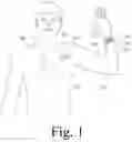 Fig. 02 - Integrated System for Managing Cardiac Rhythm Including Wearable and Implanted Devices