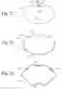 Fig. 13 - Integrated System for Managing Cardiac Rhythm Including Wearable and Implanted Devices