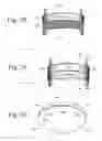 Fig. 15 - Integrated System for Managing Cardiac Rhythm Including Wearable and Implanted Devices