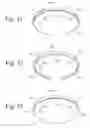 Fig. 16 - Integrated System for Managing Cardiac Rhythm Including Wearable and Implanted Devices