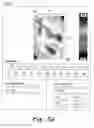 Fig. 06 - Thigh adhesion quantitative measurement system