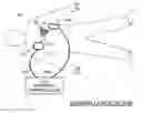 Fig. 01 - Filtering patient signal also for ventilation artifacts