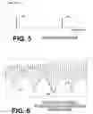 Fig. 05 - Filtering patient signal also for ventilation artifacts