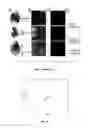 Fig. 02 - Systems Using Fingerprint images as Diagnostic Detection systems for Type 2 Diabetes