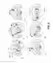 Fig. 06 - Extremity imaging apparatus for cone beam computed tomography