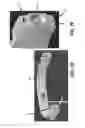 Fig. 12 - Extremity imaging apparatus for cone beam computed tomography