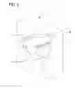 Fig. 02 - INSERT DEVICE FOR ENHANCING PET AND MRI IMAGES