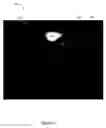 Fig. 08 - X-ray image feature detection and registration systems and methods