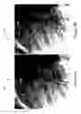 Fig. 22 - X-ray image feature detection and registration systems and methods