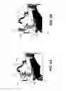 Fig. 05 - Deployable guard for mobile x-ray system