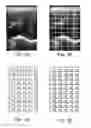 Fig. 06 - Systems and methods for automatic time gain compensation in a handheld ultrasound imaging system
