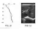 Fig. 08 - Systems and methods for automatic time gain compensation in a handheld ultrasound imaging system