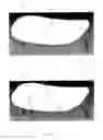 Fig. 02 - In situ specimen collection receptacle in a toilet and being in communication with a spectral analyzer