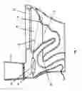 Fig. 04 - In situ specimen collection receptacle in a toilet and being in communication with a spectral analyzer