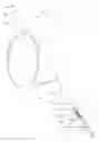 Fig. 02 - ENDOSCOPIC BIOPSY INSTRUMENT