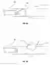 Fig. 06 - Solenoid occlusion device