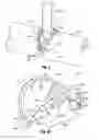 Fig. 03 - Hinged tissue support device