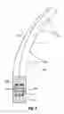 Fig. 05 - Hinged tissue support device