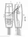 Fig. 15 - Suture anchor management