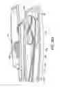 Fig. 16 - Suture anchor management