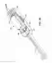 Fig. 20 - Suture anchor management