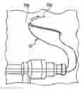 Fig. 01 - Method for knotless fixation of tissue