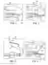 Fig. 02 - Method for knotless fixation of tissue