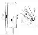 Fig. 53 - METHOD AND APPARATUS FOR CLOSING A FISSURE IN THE ANNULUS OF AN INTERVERTEBRAL DISC, AND/OR FOR EFFECTING OTHER ANATOMICAL REPAIRS AND/OR FIXATIONS