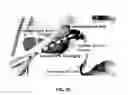 Fig. 55 - METHOD AND APPARATUS FOR CLOSING A FISSURE IN THE ANNULUS OF AN INTERVERTEBRAL DISC, AND/OR FOR EFFECTING OTHER ANATOMICAL REPAIRS AND/OR FIXATIONS