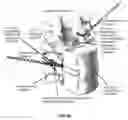 Fig. 66 - METHOD AND APPARATUS FOR CLOSING A FISSURE IN THE ANNULUS OF AN INTERVERTEBRAL DISC, AND/OR FOR EFFECTING OTHER ANATOMICAL REPAIRS AND/OR FIXATIONS