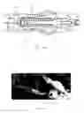 Fig. 22 - Applicator instruments for dispensing surgical fasteners having articulating shafts and articulation control elements