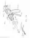 Fig. 87 - Hand held rotary powered surgical instruments with end effectors that are articulatable about multiple axes