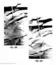 Fig. 11 - Apparatus and method for placement of device along wall of a body lumen
